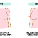 孕期与哺乳期胸型变化